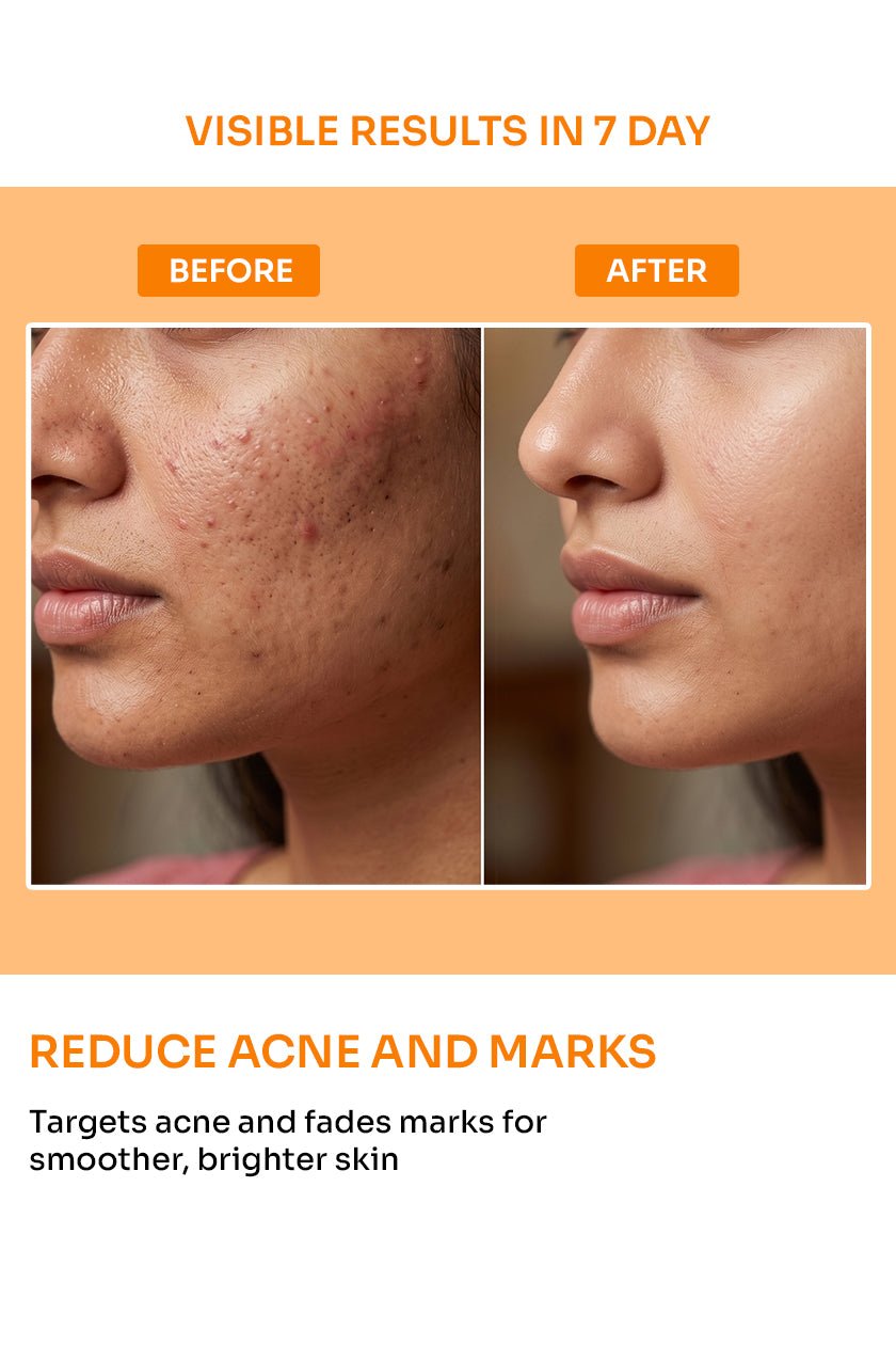 C-Bright Face Serum (Acne & Scar Repair Serum) - 30ml