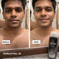 Before and after results of Vellora Dark Strom Body Wash showing cleaner, fresher skin after regular use