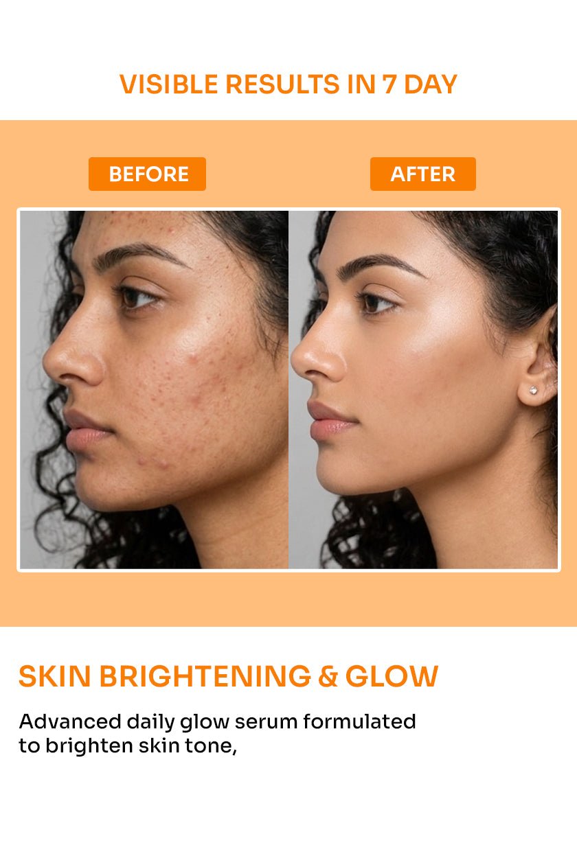 Radiglow Face Serum (Glowing Skin) with Alpha Arbutin & Camnia - 30ml