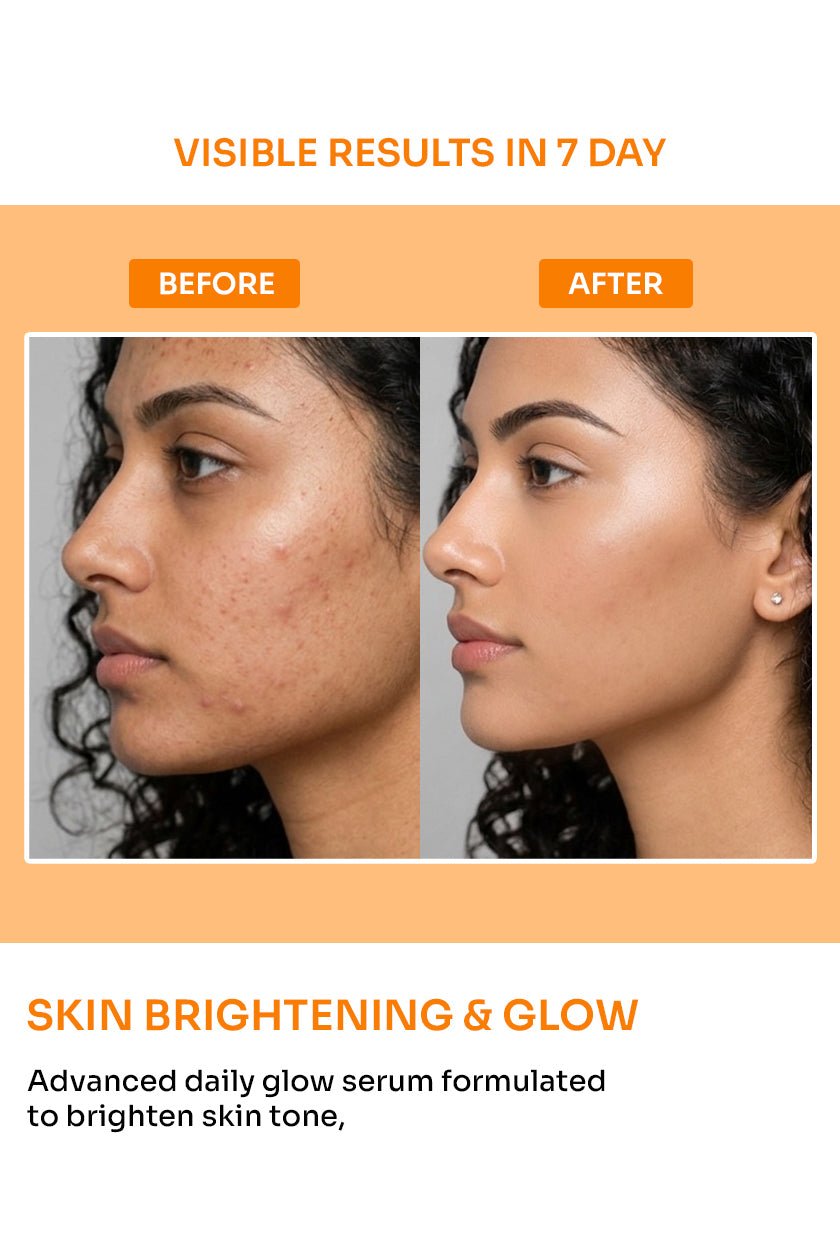 Radiglow Face Serum (Glowing Skin) with Alpha Arbutin & Camnia - 30ml