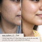 Before and after comparison showing improved skin hydration, brightness, and smoothness after using Vellora VIT-E Boost Body Lotion