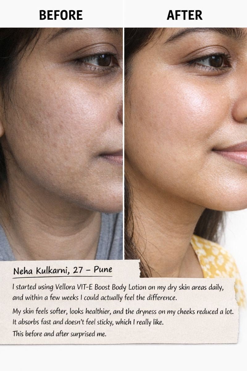 Before and after comparison showing improved skin hydration, brightness, and smoothness after using Vellora VIT-E Boost Body Lotion