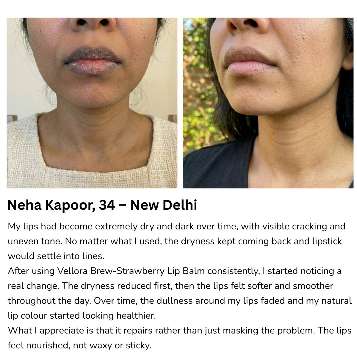 Before and after comparison showing reduced lip dryness and improved smoothness after regular use of Vellora Brew Strawberry Lip Balm.