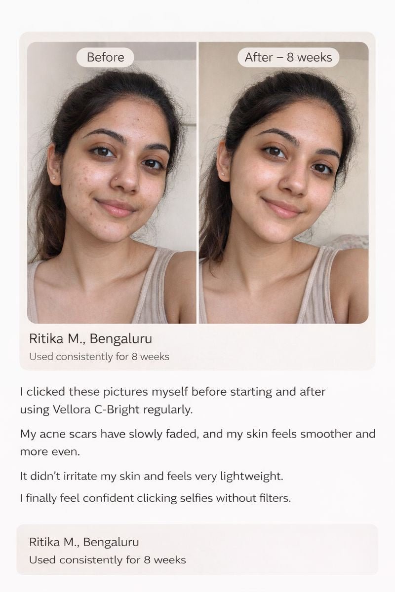Before and after results of Vellora C-Bright Face Serum showing reduced acne scars and smoother skin after 8 weeks of use