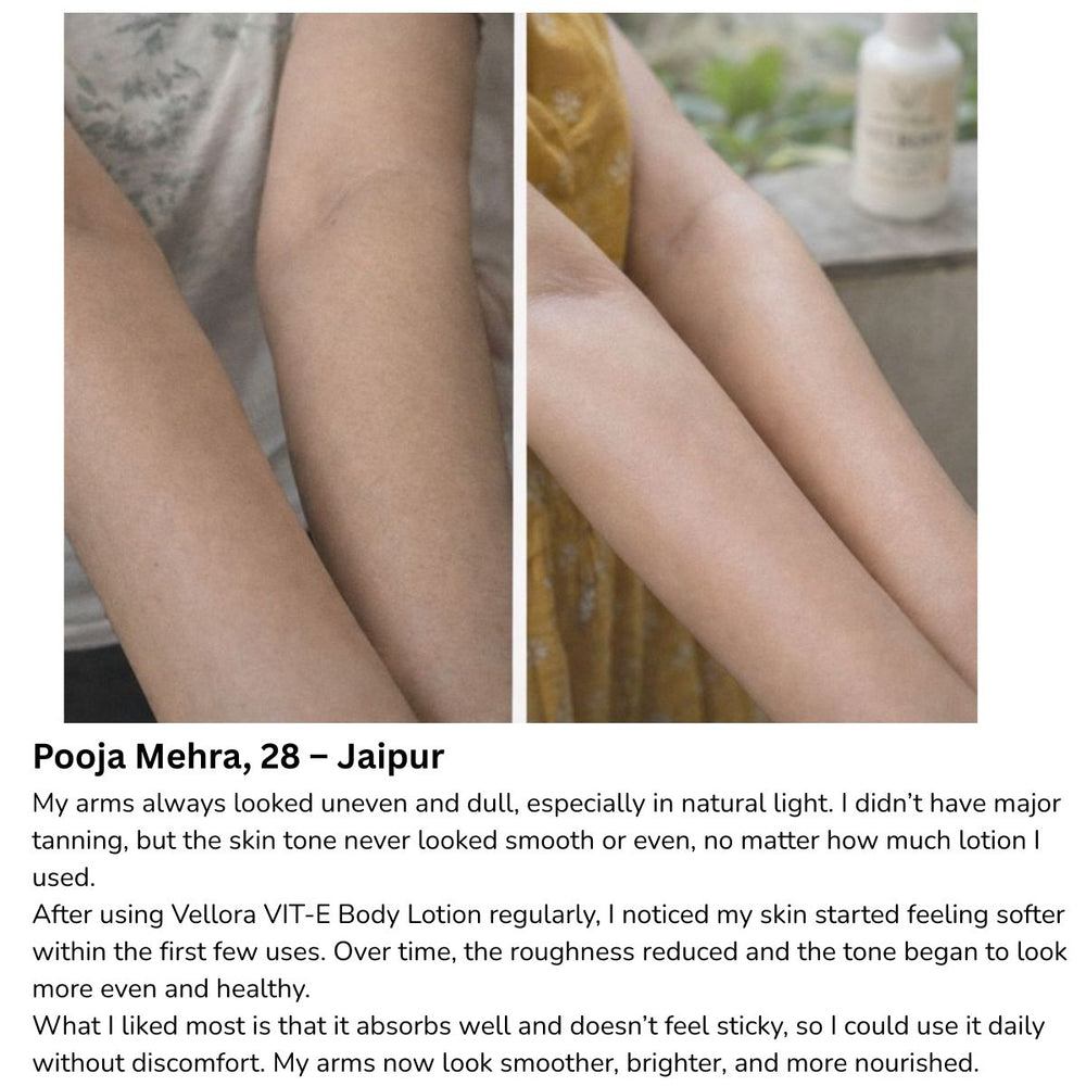 Before and after comparison of uneven, dull arm skin showing improved smoothness and even tone after regular use of Vellora VIT-E Body Lotion, shared by a customer from Jaipur.
