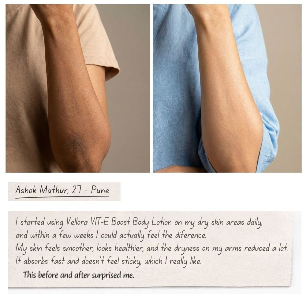 Before and after image of dry arm skin showing visible softness and reduced dryness after consistent use of Vellora Vitamin E Boost Body Lotion.