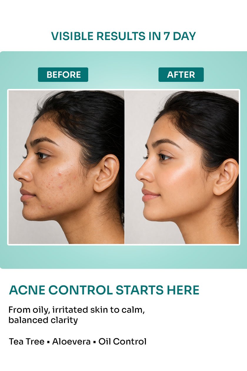 Aloeem Face Wash with 2% Niacinamide & Vitamin B5 - 125ml