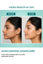 Aloeem Face Wash with 2% Niacinamide & Vitamin B5 - 50ml