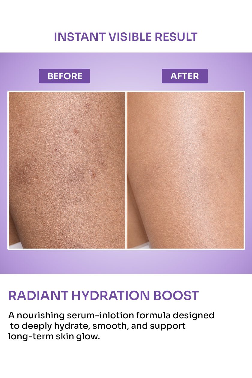 Serum Body Lotion with Vitamin C, Cica & Hyaluronate - 100ml