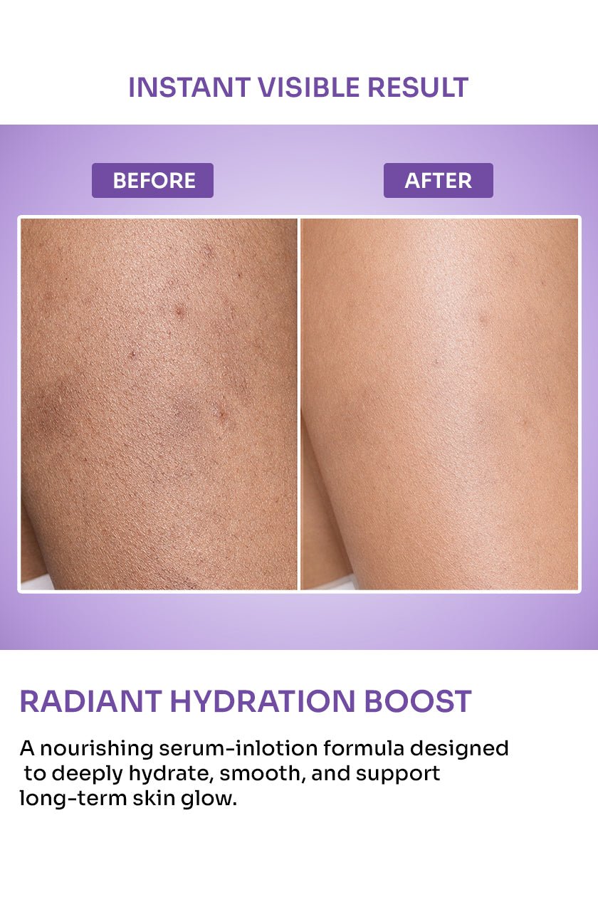 Serum Body Lotion with Vitamin C, Cica & Hyaluronate - 100ml